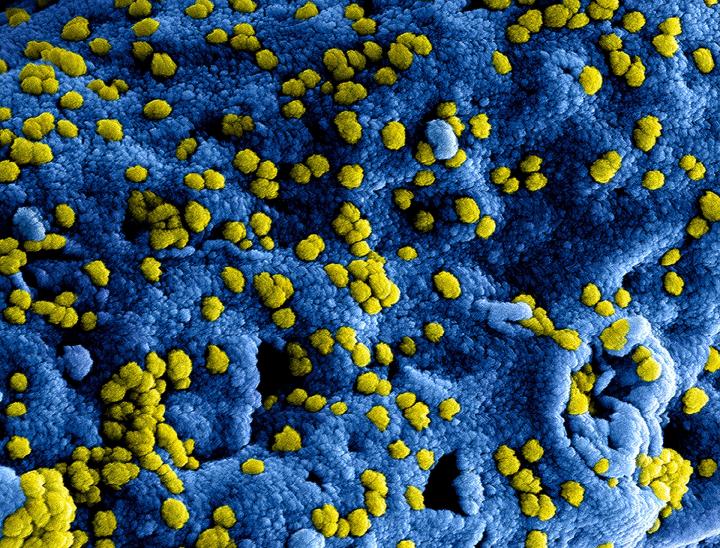 Coronavirus web
